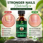Pure Care Nail Care Herbal Serum Buy 1 Get 1 Free